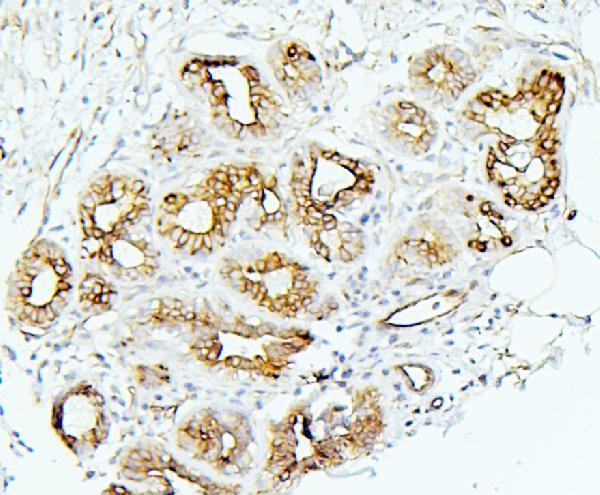 a00733 1 mmp1 primary antibodies ihc testing 2
