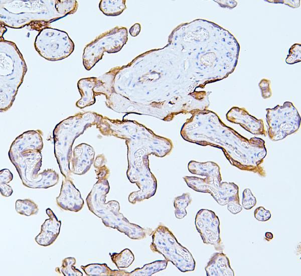 a00733 1 mmp1 primary antibodies ihc testing 3