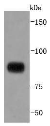 Western blot analysis of STAT4 on Daudi cells lysates using anti-STAT4 antibody at 1/1,000 dilution