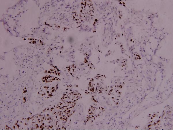 a00734y693 stat4 primary antiboties ihc testing 2