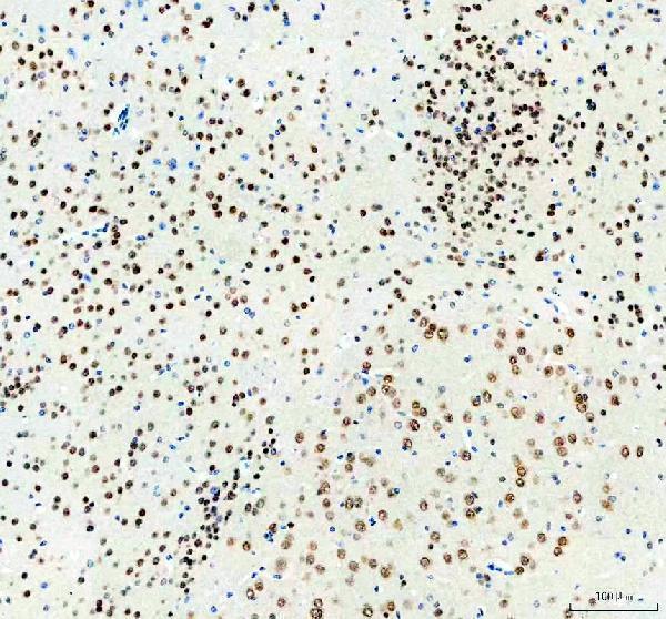 a00736 1 hur elavl1 primary antibodies ihc testing 4