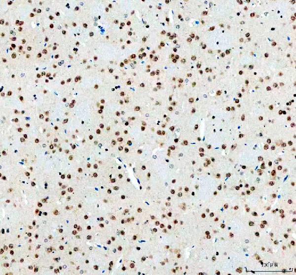 a00736 1 hur elavl1 primary antibodies ihc testing 5