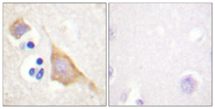 Immunohistochemical analysis of paraffin-embedded Human brain
