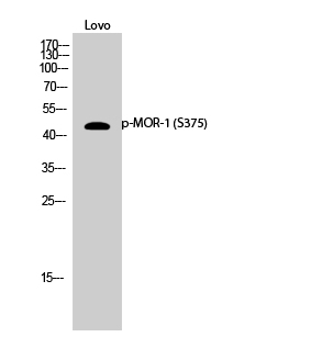 Western Blot analysis of Lovo cells using Phospho-MOR-1 (S375) Polyclonal Antibody