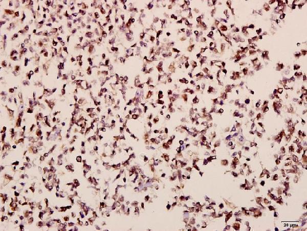 Immunohistochemistry (IHC) analyzes of MOR-1 (S57) pAb in paraffin-embedded human tonsil carcinoma tissue at 1:50