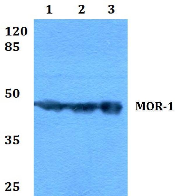 Western blot (WB) analysis of MOR-1 (S57) polyclonal antibody at 1:500 dilution
Lane1:HEK293T whole cell lysate
Lane2:Raw264
