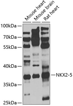 a00738 nkx2 5 primary antiboties wb testing 1