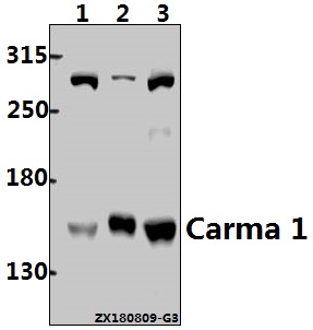 Western blot (WB) analysis of Carma 1 (M12) pAb at 1:500 dilution
Lane1:K562 whole cell lysate(40ug)
Lane2:The Thymus tissue lysate of Rat(30ug)
Lane3:Myla2059 whole cell lysate(40ug)