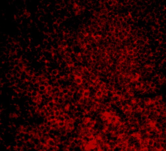 Immunofluorescence of CARMA1 in Mouse Spleen cells with CARMA1 antibody at 20 μg/mL