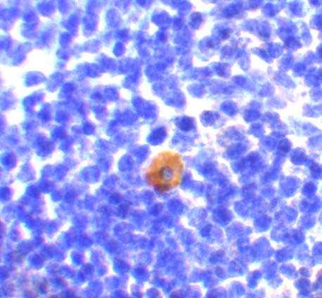 Immunohistochemistry of CARMA1 in mouse thymus with CARMA1 antibody at 10 μg/mL