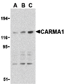 Western blot analysis of CARMA1 expression in mouse thymus cell lysate with CARMA1 antibody at 0