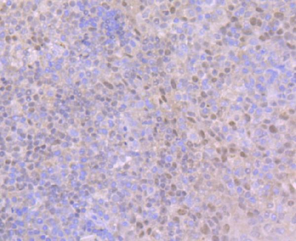 a00741 bcl11a primary antiboties ihc testing 2