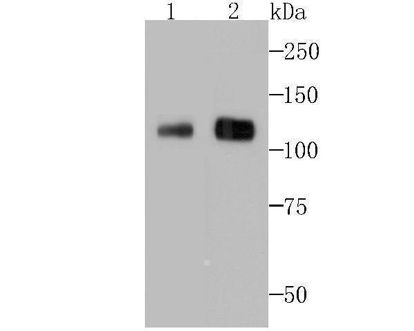 a00741 bcl11a primary antiboties wb testing 1