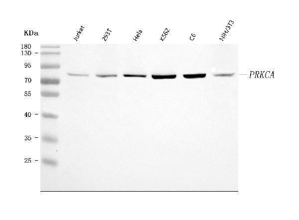  Western blot analysis of PKC Alpha/PRKCA using anti-PKC Alpha/PRKCA antibody (A00743-1)