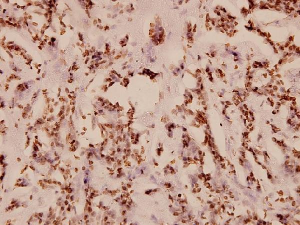 a00743t495 prkca primary antiboties ihc testing 2