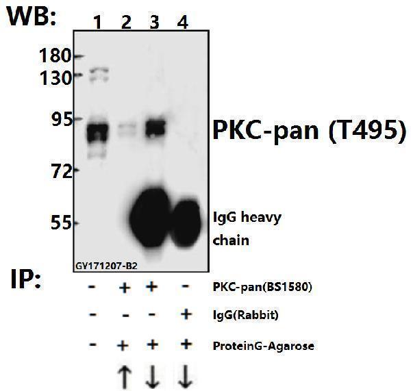 a00743t495 prkca primary antiboties ip testing 3