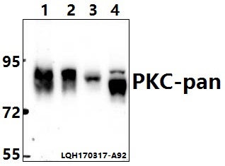 a00743t495 prkca primary antiboties wb testing 1