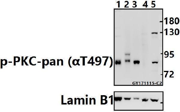 Western blot (WB) analysis of p-PKC-pan (αT497) pAb at 1:500 dilution
Lane1:The Spleen tissue lysate of Mouse(40ug)
Lane2:The Brain tissue lysate of Rat(40ug)
Lane3:Hela whole cell lysate(20ug)
Lane4:HEK293T whole cell lysate(40ug)
Lane5:A549 whole cell lysate(40ug)
