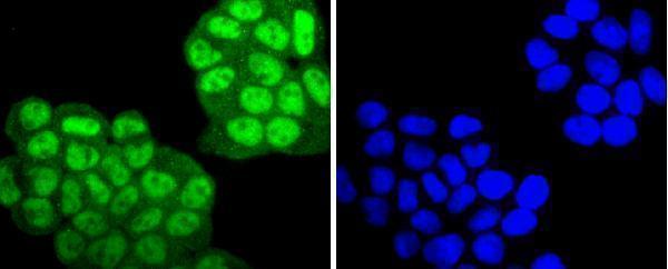 ICC staining Phospho-PKC alpha(T638) in Hela cells (green)