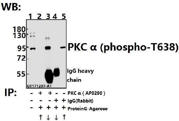 Immunoprecipitation of L02 cell lysate using PKC α (phospho-T638) pAb (Sepharose Bead Conjugate) #BD0048(lane 2 and lane 3) and Nonspecific IgG  Control (Sepharose Bead Conjugate)#BD0048 (lane 4) 