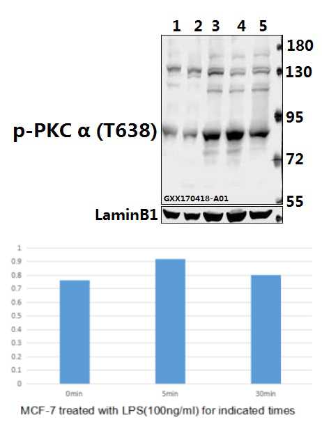 Western blot (WB) analysis of PKC α (phospho-T638) polyclonal antibody at 1:500 dilution
Lane1:PC12 whole cell lysate(40ug)
Lane2:CT26 whole cell lysate(40ug)
Lane3:MCF-7 treated with LPS(100ng/ml) for 30 minutes whole cell lysate
Lane4:MCF-7 treated with LPS(100ng/ml) for 5 minutes whole cell lysate
Lane5:MCF-7 whole cell lysate