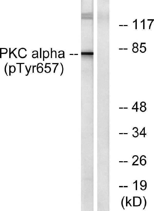 a00743y657 prkca primary antibodies wb testing 3