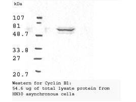 Western blot analysis using Boster