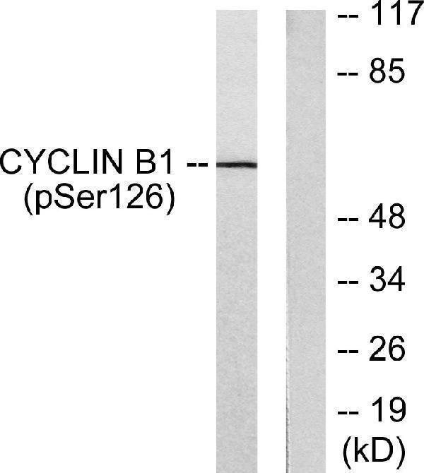 Western blot analysis of lysates from NIH/3T3 cells treated with EGF 200ng/ml 15