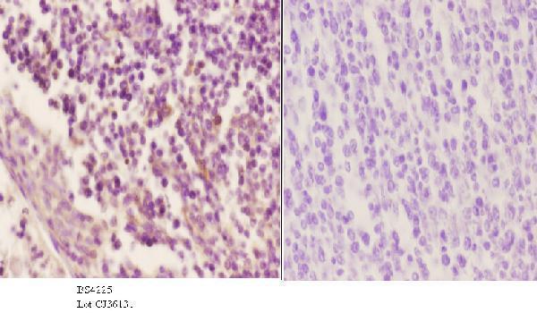 Immunohistochemistry (IHC) analyzes of p-Cyclin B1 (S126) pAb in paraffin-embedded human tonsil carcinoma tissue at 1:50