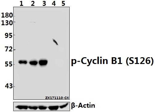 Western blot (WB) analysis of p-Cyclin B1 (S126) pAb at 1:500 dilution
Lane1:MCF-7 whole cell lysate(40ug)
Lane2:HEK293T whole cell lysate(40ug)
Lane3:SGC7901 whole cell lysate(40ug)
Lane4:3T3-L1 whole cell lysate(40ug)
Lane5:PC12 whole cell lysate(40ug)