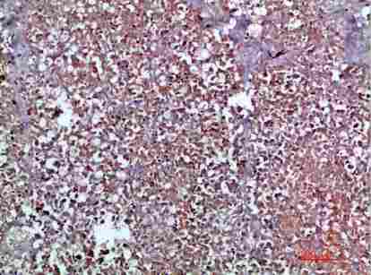 Immunohistochemical analysis of paraffin-embedded human-pancreas, antibody was diluted at 1:200
