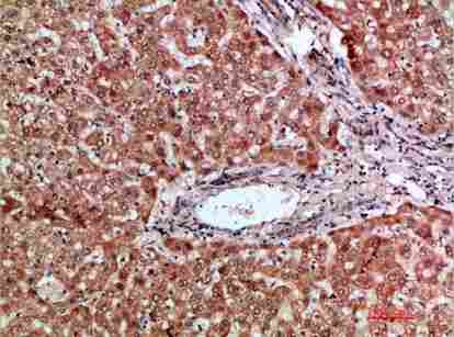 Immunohistochemical analysis of paraffin-embedded human-liver, antibody was diluted at 1:200