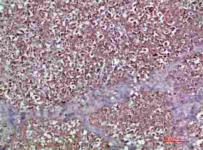 Immunohistochemical analysis of paraffin-embedded human-pancreas, antibody was diluted at 1:200