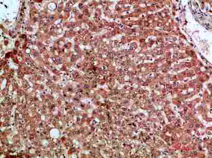 a00748 ccl20 primary antibodyes ihc testing 4