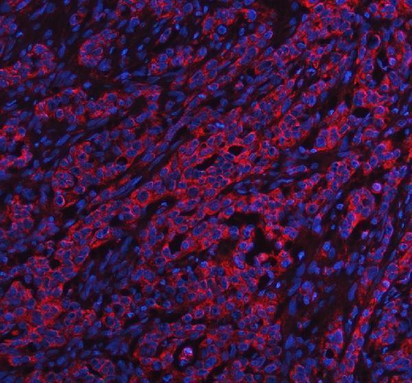 a00749 1 mtm1 primary antibodies if testing 1