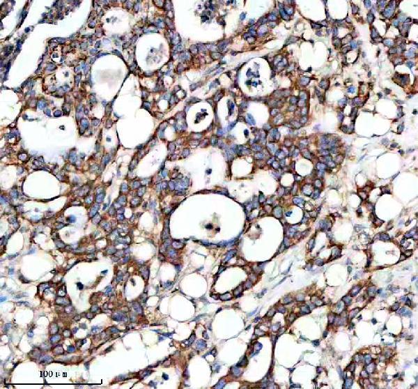 IHC analysis of MTM1 using anti-MTM1 antibody (A00749-1)