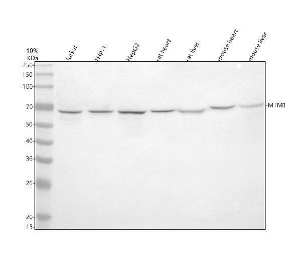 Western blot analysis of MTM1 using anti-MTM1 antibody (A00749-1)