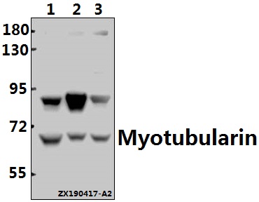 Western blot (WB) analysis of Myotubularin (Y290) pAb at 1:2000 dilution
Lane1:SGC7901 whole cell lysate(40ug)
Lane2:HCT116 whole cell lysate(40ug)
Lane3:Panc1 whole cell lysate(40ug)