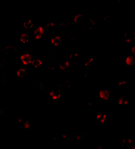 Immunofluorescence of DISC1 in HeLa cells with DISC1 antibody at 20 μg/mL