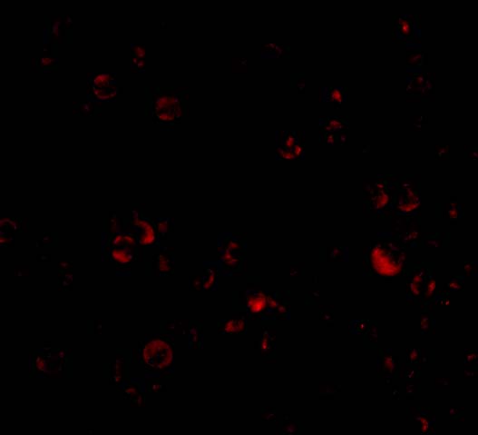 Immunofluorescence of DDX3 in HepG2 cells with DDX3 antibody at 20 μg/mL