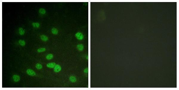 a00751t322 ddx3x primary antibodies if testing 5