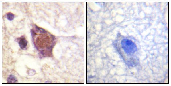 Immunohistochemistry analysis of paraffin-embedded human brain, using DDX3/DEAD-box Protein 3 (Phospho-Thr322) Antibody