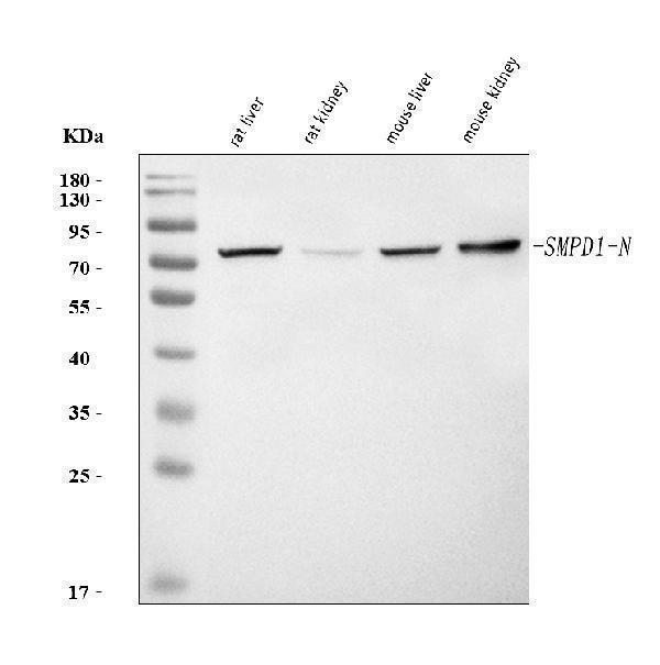  Western blot analysis of Smpd1 using anti-Smpd1 antibody (A00752-1)