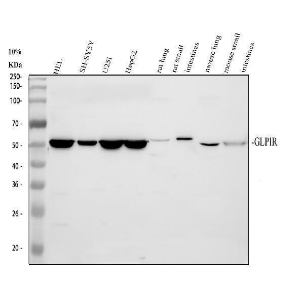 a00753 4 glp1r primary antibodies wb testing 1