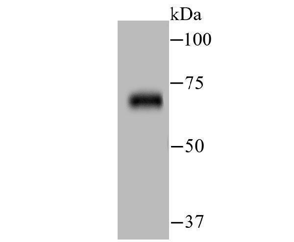 Western blot analysis of ZAP70 on human thymus tissue lysate using anti-ZAP70 antibody at 1/500 dilution