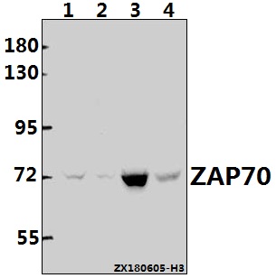 Western blot (WB) analysis of ZAP70 (T286) at 1:500 dilution
Lane1:THP-1 whole cell lysate(40ug)
Lane2:Myla2059 whole cell lysate(40ug)
Lane3:HuT78 whole cell lysate(40ug)
Lane4:The Thymus tissue lysate of Rat(40ug)