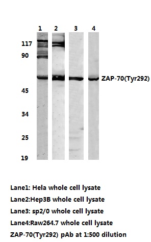 Western blot (WB) analysis of ZAP70 (Tyr292) pAb