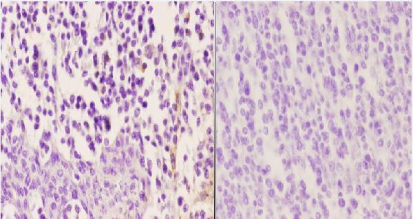 Immunohistochemistry (IHC) analyzes of p-ZAP70 (Y315) pAb in paraffin-embedded human tonsil carcinoma tissue at 1:50