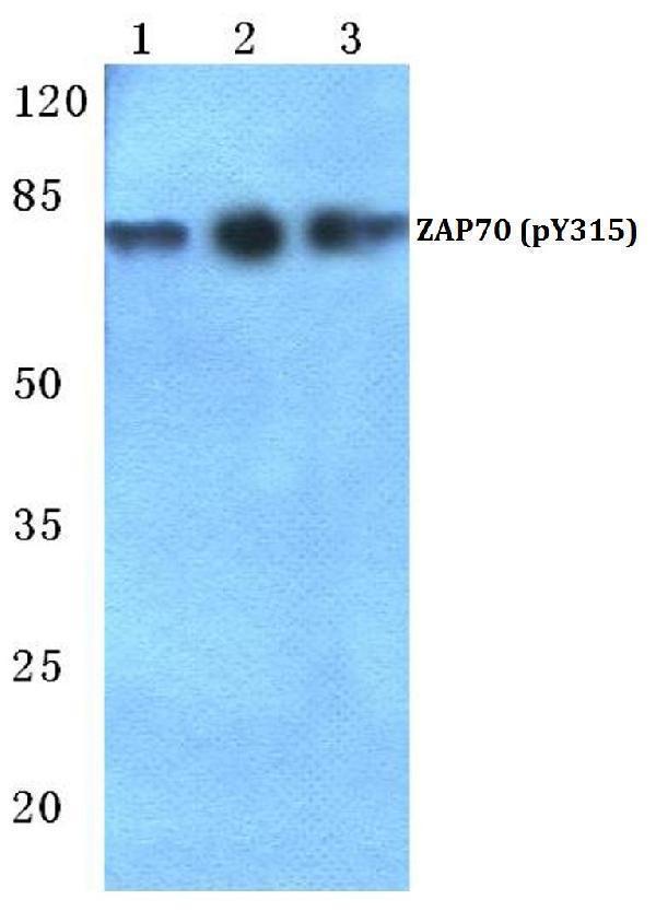 Western blot (WB) analysis of p-ZAP70 (Y315) polyclonal antibody at 1:500 dilution
Lane1:Hela cell lysate treated with H2O2(100µM,15mins)
Lane2:Mouse kidney tissue lysate
Lane3:Rat kidney tissue lysate