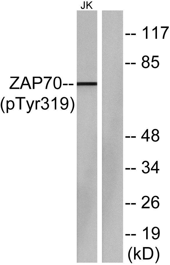 Western blot analysis of lysates from Jurkat cells, using ZAP-70 (Phospho-Tyr319) Antibody